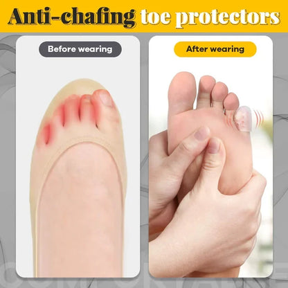 Silicone Anti-Friction Toe Protector